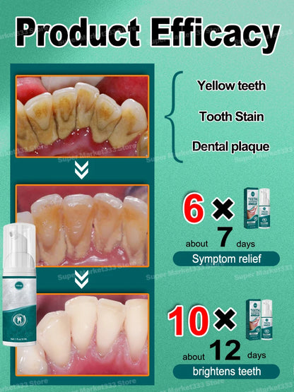 Solve all dental problem tooth decay repair tooth repair fast teeth whitening clean teeth teeth repair cavities