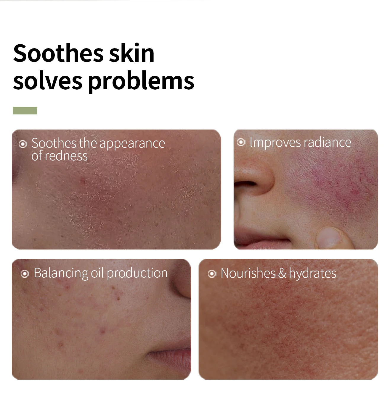 15Ml Essential Oils for Face 100% Natural Essential Oils Set  Vitamin C Facial Care Essence Oil Soothing Moisturizing Rose oil