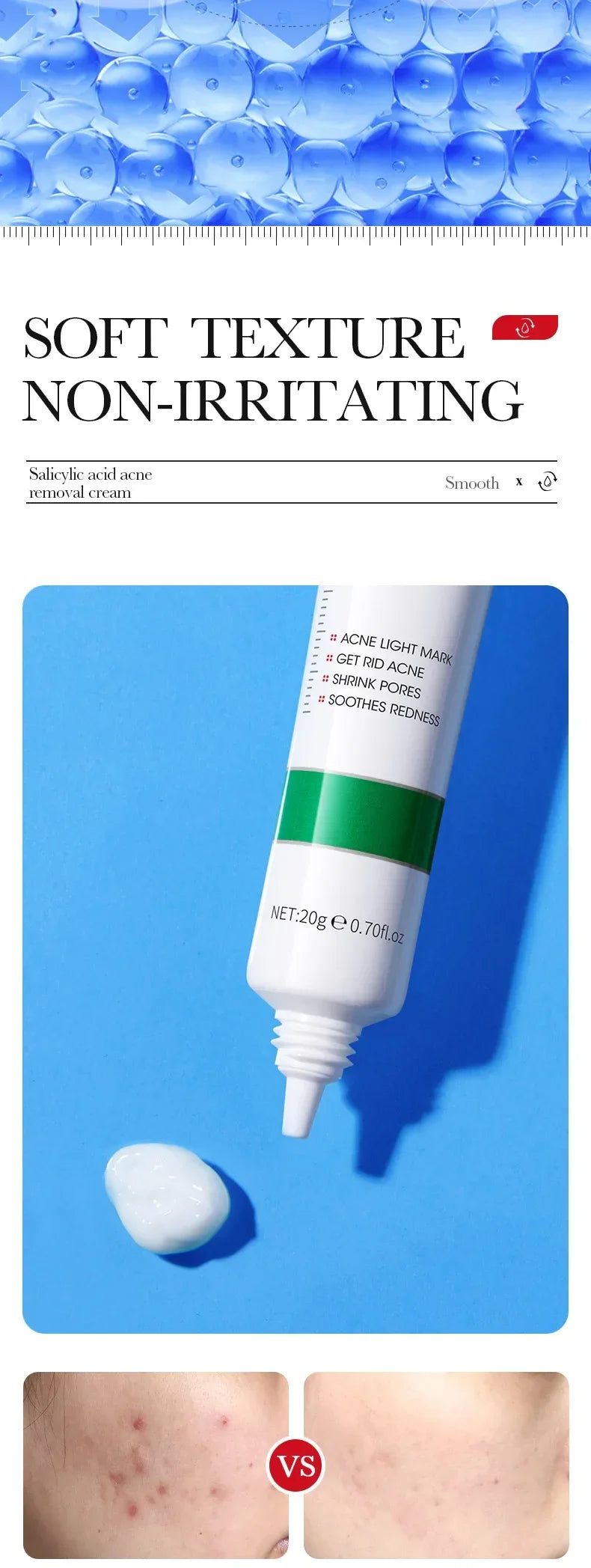 Salicylic Acid Face Cream Acne Creams Mark Repair Firming Moisturizing Blackhead Remover skincare Facial Cream