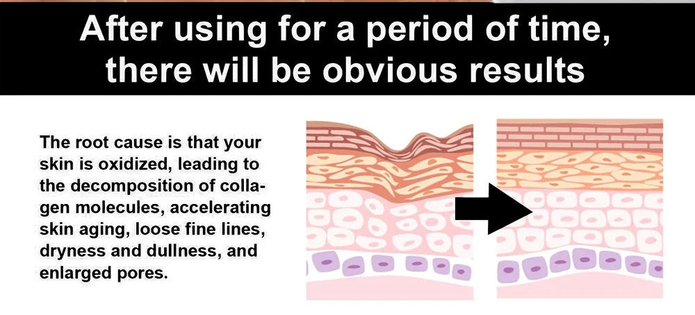 Hyaluronic Acid Retinol Collagen Face Cream Firming Creams Moisturizing Brightening Face Creams Beauty Facial Skin Care Products