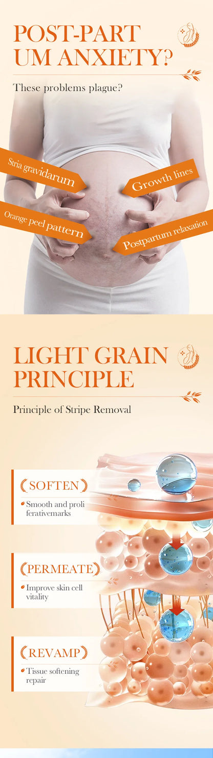 Stretch Marks Permanent Removal Cream Stretch Marks Maternity Improves Fine Stretch Mark Remove Skin Cracks Firming Body Creams