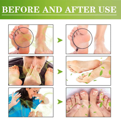 Fresh Foot Deodorant Spray Foot Spray Shoe Odor Remover For Sweaty Feet Natural Shoe Deodorizer And Foot Spray