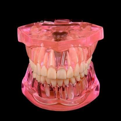 Dental Models Removable And Restorable Models Of Diseased Teeth For Teaching And Researching Medical And Dental Diseases