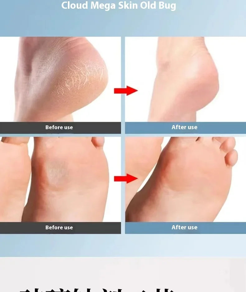 Foot grinder to remove dead skin foot rubbing board grinding calluses nano glass foot scrubber repair foot scraping heel tool