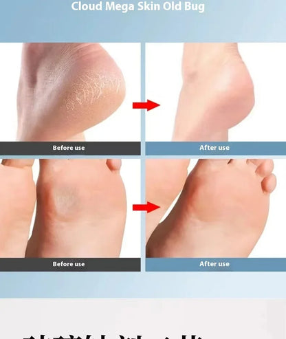 Foot grinder to remove dead skin foot rubbing board grinding calluses nano glass foot scrubber repair foot scraping heel tool