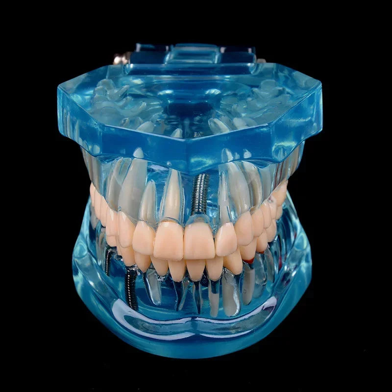 Dental Models Removable And Restorable Models Of Diseased Teeth For Teaching And Researching Medical And Dental Diseases