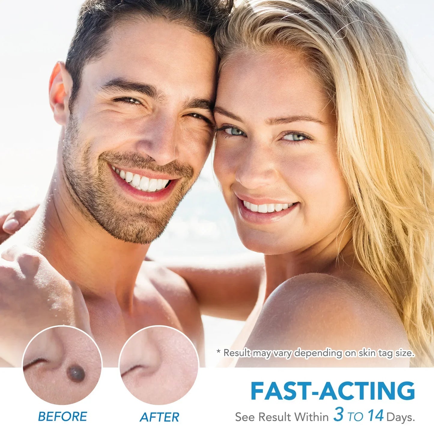 Simple Wart Removal Tool Set Skin Tag Removeal Tool Easy To Clean Skin Care Tool Skin Tag Removal Care Products