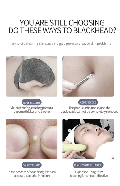 Home Use Ultrasonic Skin Scrubber Blackhead Remover Tool for Face Pore Cleaner with 2 Modes Waterproof Facials Skin Care Product
