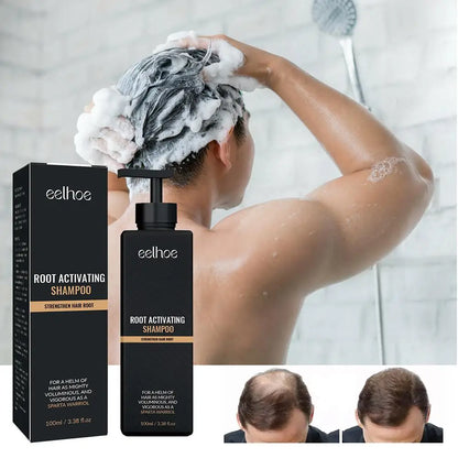 2PCS Anti Baldness Shampoo Thickening Shampoo Root Activator Shampoo Nourish Hair Regrowth Shampoo For Thinning Hair & Hair Loss