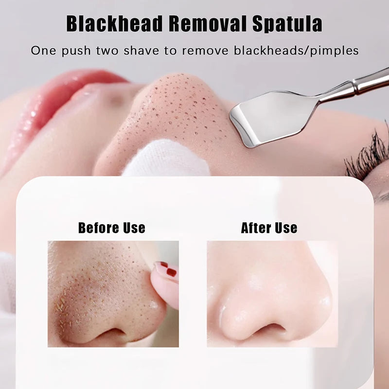 Facial Skin Scrubber Face Spatula Exfoliator Deep Cleansing Tool Blackhead Remover Pore Cleaner Body Skin Spatula Skin Care Tool
