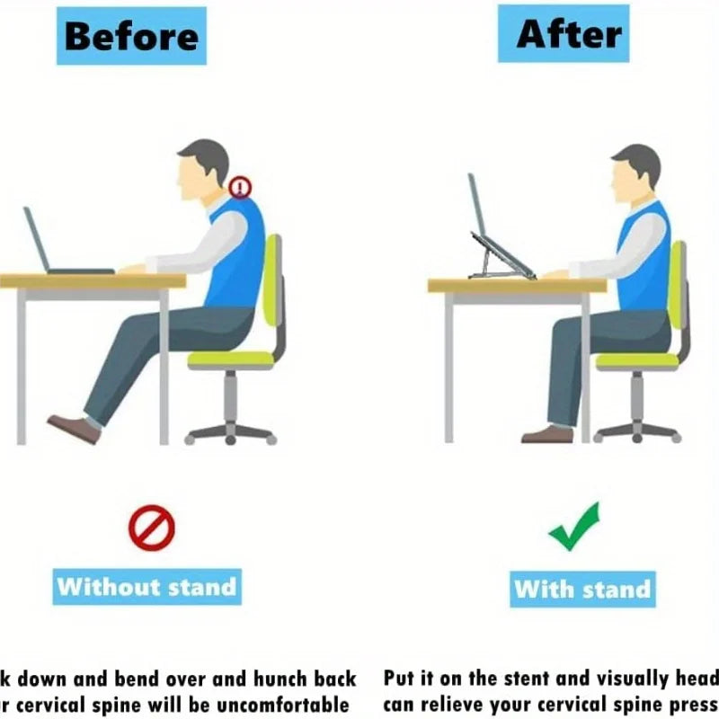 Portable Laptop Stand, Ergonomic Aluminium Laptop Mount Stand, Detachable Laptop Riser Notebook Holder Stand Compatible