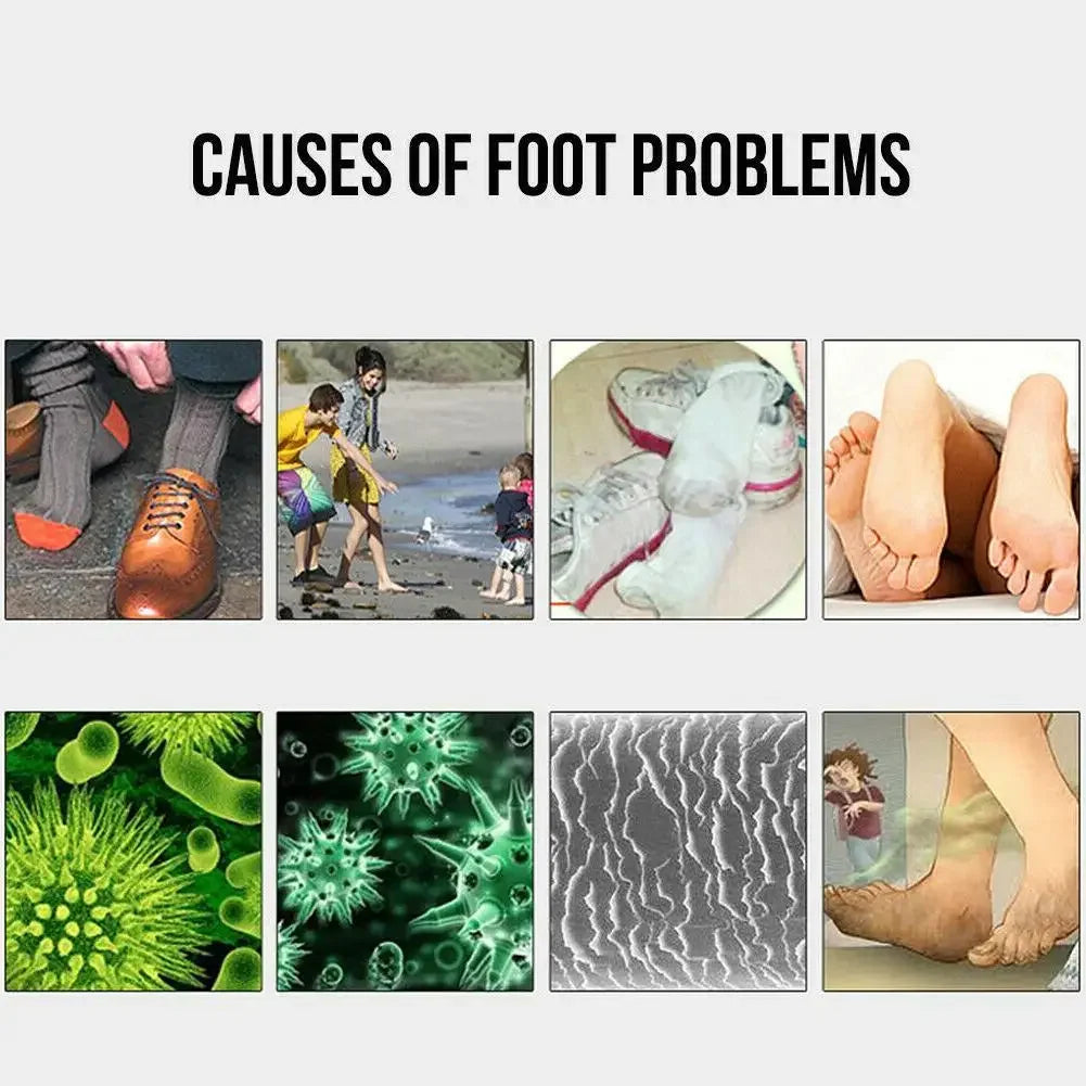 Socks Shoes Deodorant Spray Shoes Stink Freshener Socks Odor Remover Spray Refresh Antiperspirant Foot Sweat Odor Remover 100ML