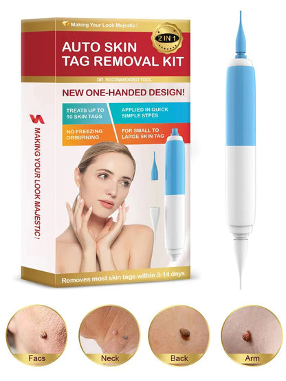 Skin Tag Removal Tool Rubber Rings Face Beauty Accessories Skin Tag Removal Device Multipurpose Supplies for Face Neck Chin Back
