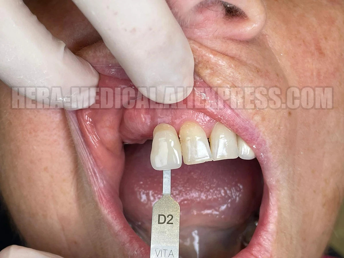 Dental Photo LED Light. Dental Photography Light. Macro, Polarizer, Intraoral, Denture Photo With Phone Lamp For Dentistry