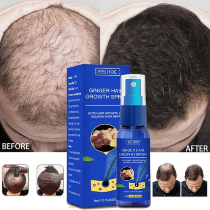Ginger Hair Growth spray Anti Hair Fall Hair Loss Treatment Hair Growth Essence Oil for Men Women hair treatment