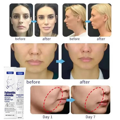 Roller Massager V-Shape Firming Face-lift Slimming Cream Removal Masseter Muscle Double Chin Face Fat Burning Anti-aging Product