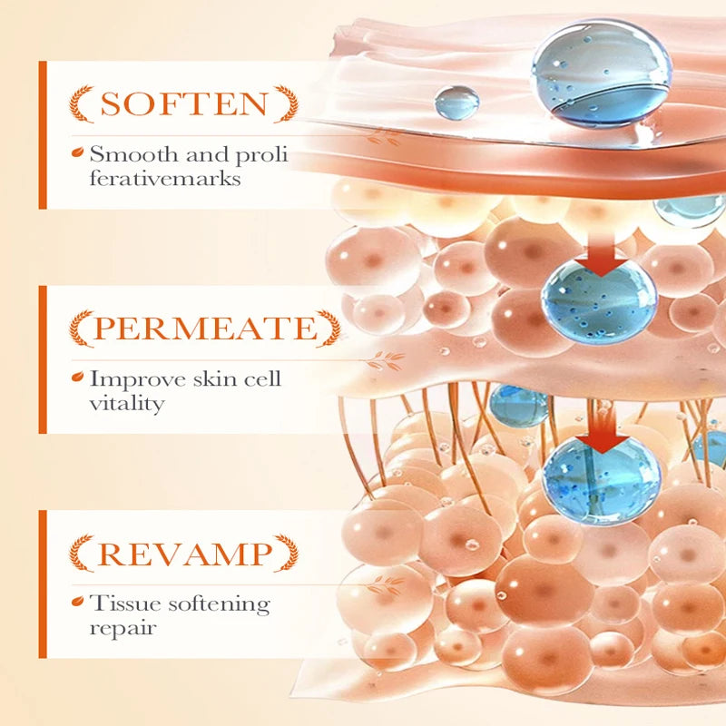 Stretch Marks Permanent Removal Cream Stretch Marks Maternity Improves Fine Stretch Mark Remove Skin Cracks Firming Body Creams