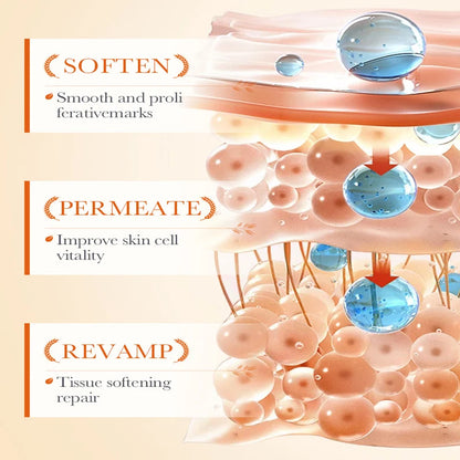 Stretch Marks Permanent Removal Cream Stretch Marks Maternity Improves Fine Stretch Mark Remove Skin Cracks Firming Body Creams