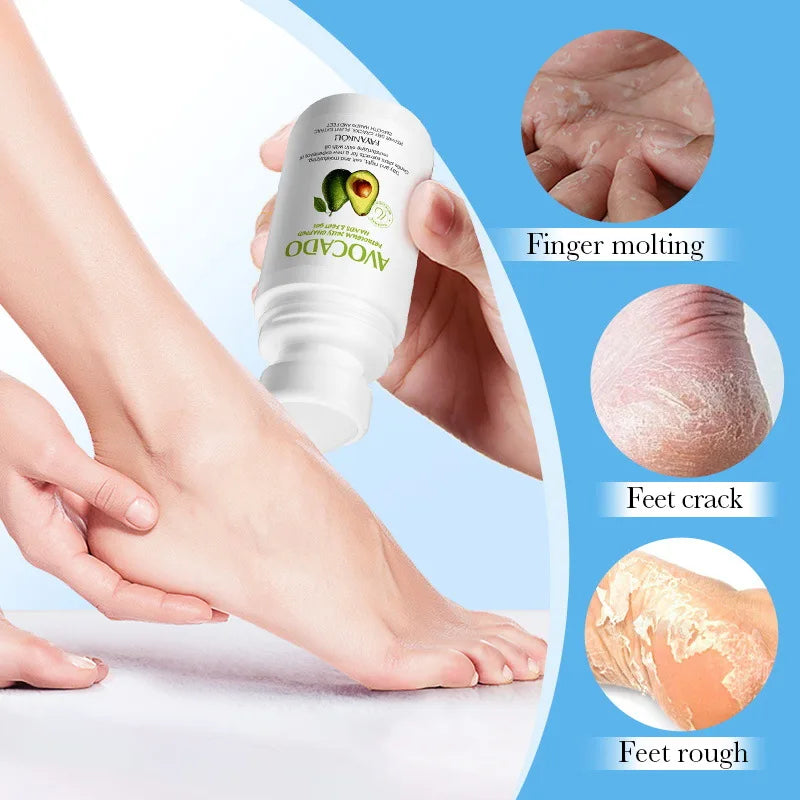Avocado Hand and Foot Cream Condensation Bead Rolling Creams Moisturizing Nourishing Repairing Feet Hands skincare Creams