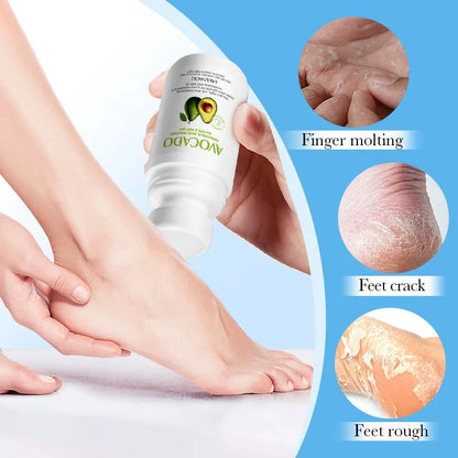 Avocado Hand and Foot Cream Condensation Bead Rolling Creams Moisturizing Nourishing Repairing Feet Hands skincare Creams