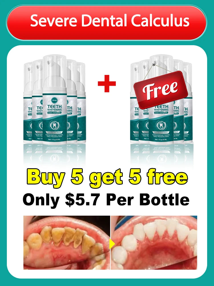 Solve all dental problem tooth decay repair tooth repair fast teeth whitening clean teeth teeth repair cavities