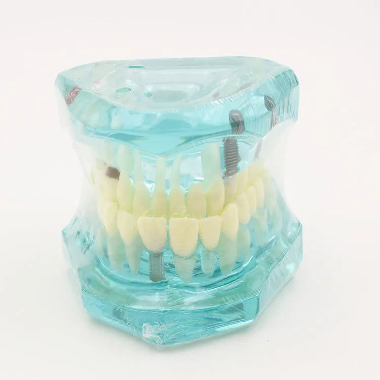 Dental Models Repairable Resin Models Of Diseased Teeth For Teaching And Research In Medicine And Dental Diseases