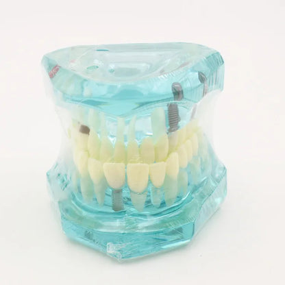 Dental Models Repairable Resin Models Of Diseased Teeth For Teaching And Research In Medicine And Dental Diseases