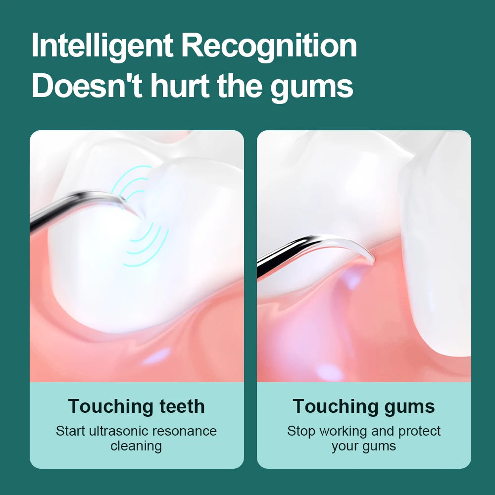 Electric Dental Scaler For Teeth 4 LED Tartar Stain Ultrasonic Tooth 1200mAh Clean Stone Health Care 4 Axis IPX7