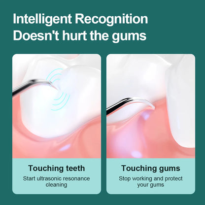 Electric Dental Scaler For Teeth 4 LED Tartar Stain Ultrasonic Tooth 1200mAh Clean Stone Health Care 4 Axis IPX7