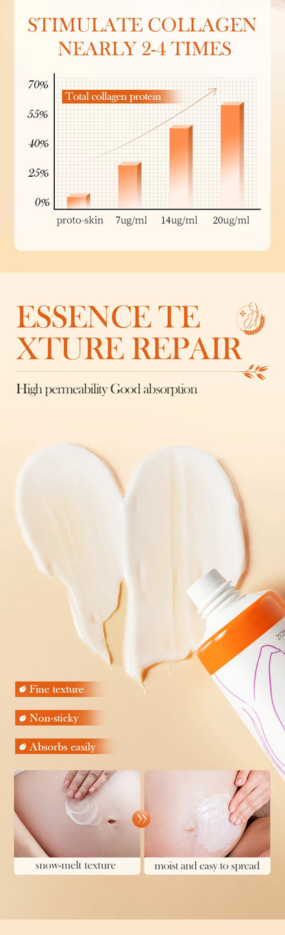 Stretch Marks Permanent Removal Cream Stretch Marks Maternity Improves Fine Stretch Mark Remove Skin Cracks Firming Body Creams