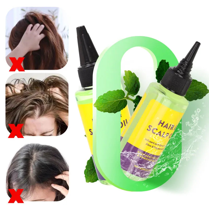 Hair Scalp Oil 65Ml Anti Drynes Soothes Itchy Scalp And Removes Product Build Up Infused With Bacuri Butter Aloe&Peppermint Oil