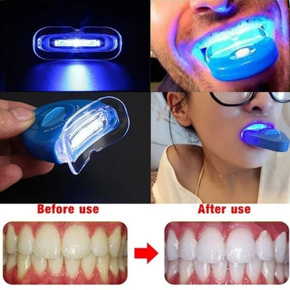 LED Teeth Whitening Light Whitening Blue Light UV Light Bleaching Laser Teeth Bleaching Whiten Lamp Personal Dentals Treatments