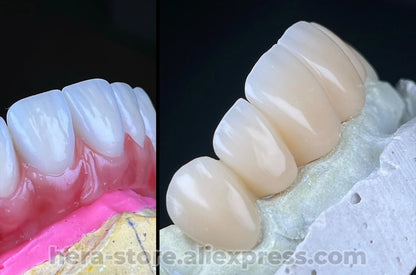 Dental Photo LED Light. Dental Photography Light. Macro, Polarizer, Intraoral, Denture Photo With Phone Lamp For Dentistry
