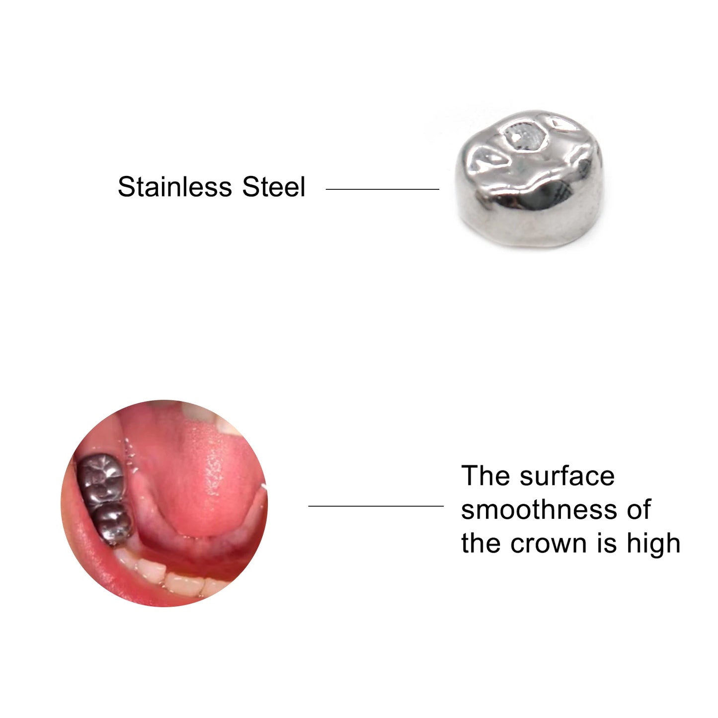 10pcs/lot Dental Primary Molar Crown Teeth 1st 2nd Preformed Stainless Steel Temporary Crowns Kit Adult Kids Dentistry