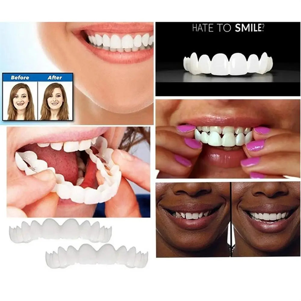 Snap On Teeth Veneers Cover The Imperfects Teeth Fake Tooth Instant Confidence Smile Temporary Teeth Teeth Beauty Tool Cosmetic