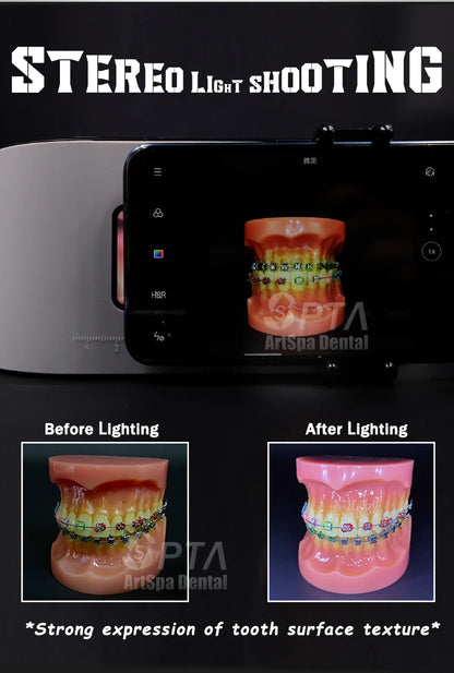 Flash Dental Photography Light Cutting Edge LED Lamp Designed Dentists Equipment Provides Optimal Lighting Oral Filling