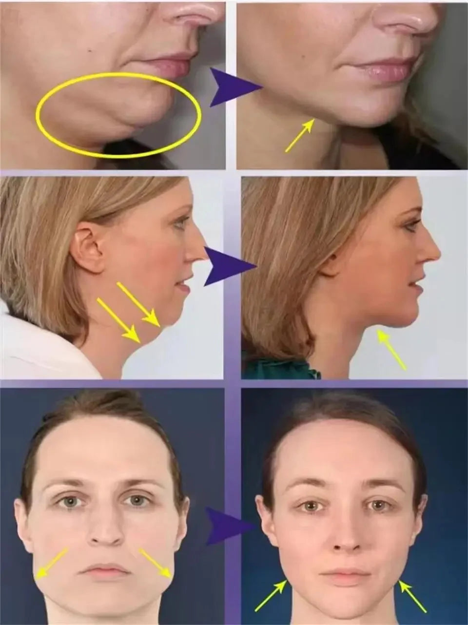 Roller Massager V-Shape Firming Face-lift Slimming Cream Removal Masseter Muscle Double Chin Face Fat Burning Anti-aging Product