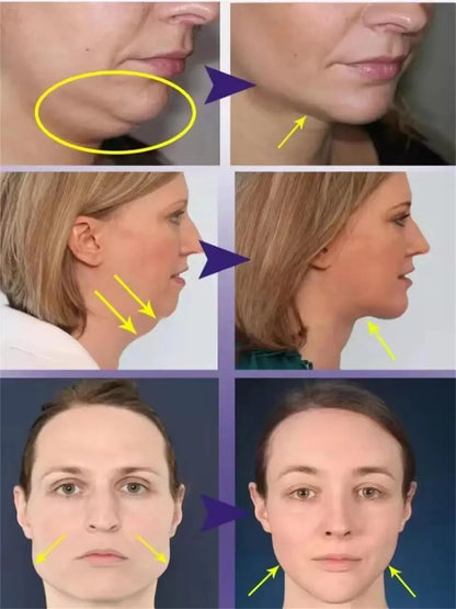 Roller Massager V-Shape Firming Face-lift Slimming Cream Removal Masseter Muscle Double Chin Face Fat Burning Anti-aging Product