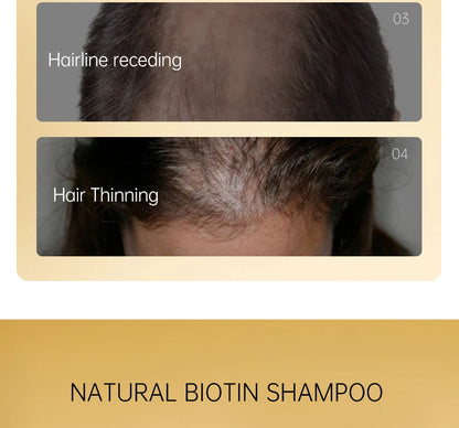 PURC 300ML Biotin Hair Shampoo Scalp Cleaning Nourishing Strengthen Roots Shampoos Hair Care Products for All Hair Types