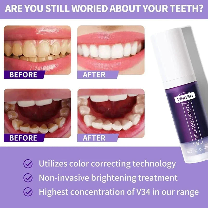 V34 Teeth Whitening Toothpaste 5D Teeth Whitening Stick Oral Hygiene Cleaning Teeth Whitening Tool Fresh Breath Teeth Care 2025