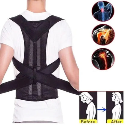Men's AND WOMEN'S Scoliosis Corrector Kyphosis Corrector Student Adult Posture Corrector Anti-kyphosis Fixed Strap