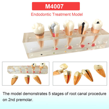 Dental Teeth Model Dental Teaching Models Implant Model Removable Dentistry Model Teeth For Training Studying Patient Education