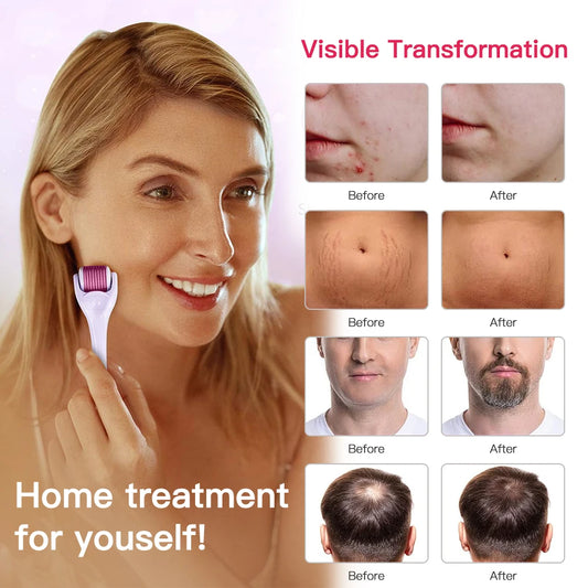 540 Derma Roller for Hair Beard Regrowth 0.2/0.25/0.3mm Titanium Needles Anti Acne Remove Wrinkles Skin Care Roller