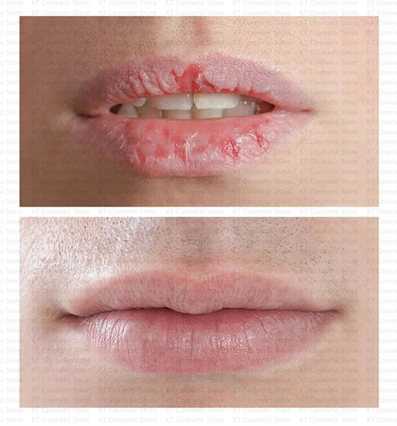 Men Lip Balm Moisturizing Hydration Fading Lip Lines Anti-Cracking Remove Dead Skin Refreshing And Not Greasy Exquisite Lip Care