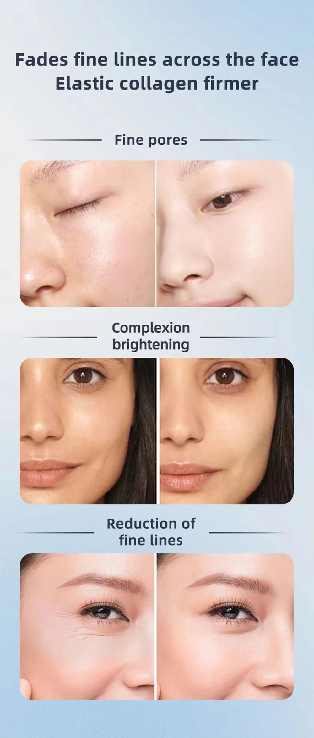 RF Facial Massage Roller EMS Face Lifting Machine Microcurrent Skin Tightening Face V-line Beauty Device Eye Roller Skin Care