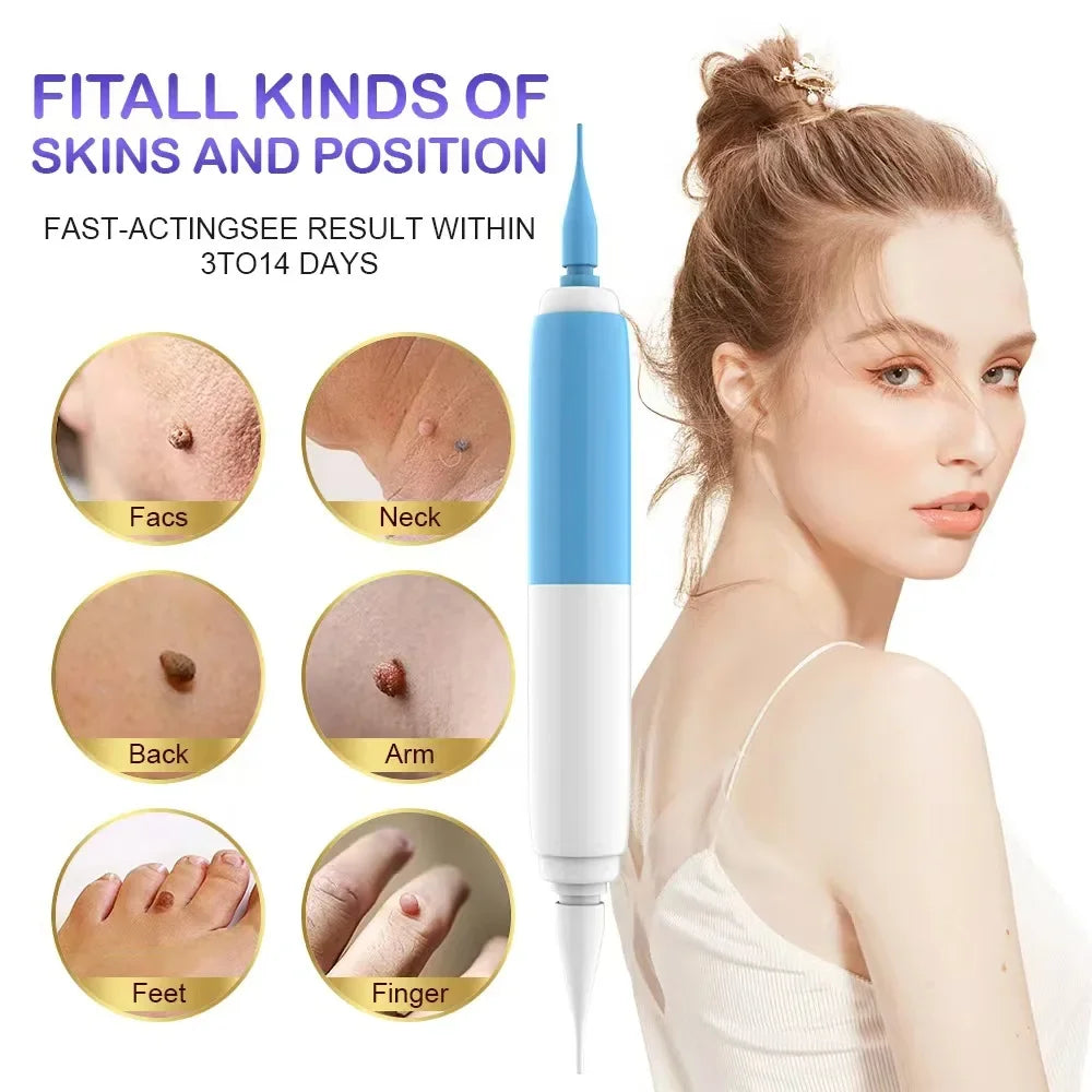 Skin Tag Removal Tool Rubber Rings Face Beauty Accessories Skin Tag Removal Device Multipurpose Supplies for Face Neck Chin Back