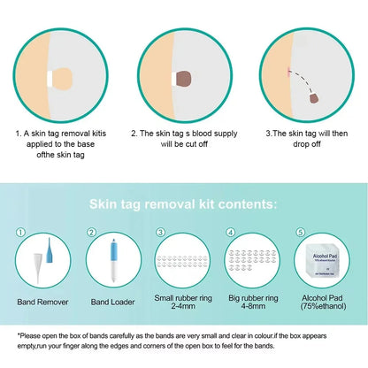 Skin Tag Removal Tool Rubber Rings Face Beauty Accessories Skin Tag Removal Device Multipurpose Supplies for Face Neck Chin Back