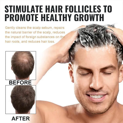 2PCS Anti Baldness Shampoo Thickening Shampoo Root Activator Shampoo Nourish Hair Regrowth Shampoo For Thinning Hair & Hair Loss