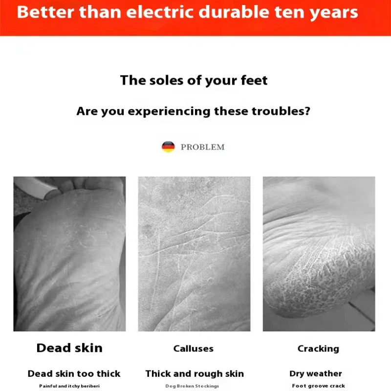 Foot grinder to remove dead skin foot rubbing board grinding calluses nano glass foot scrubber repair foot scraping heel tool