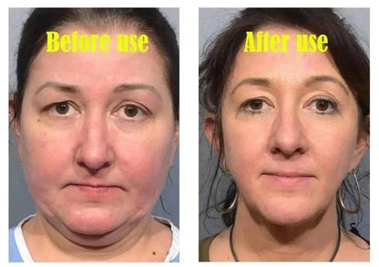 Roller Massager V-Shape Firming Face-lift Slimming Cream Removal Masseter Muscle Double Chin Face Fat Burning Anti-aging Product